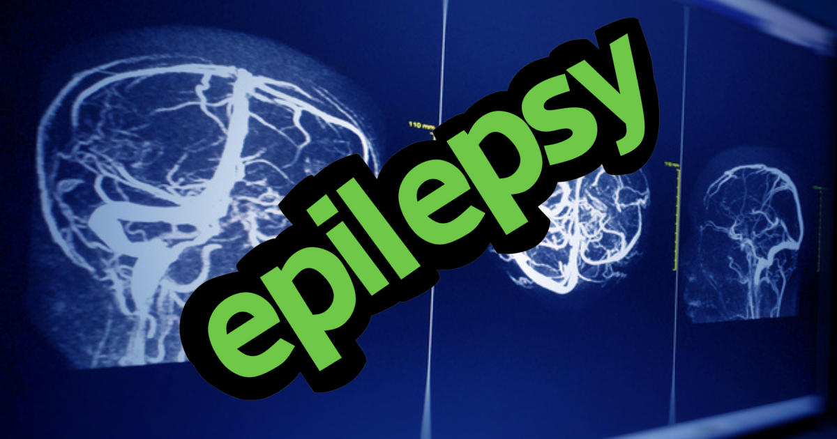 Epilepsy: the complex brain disease